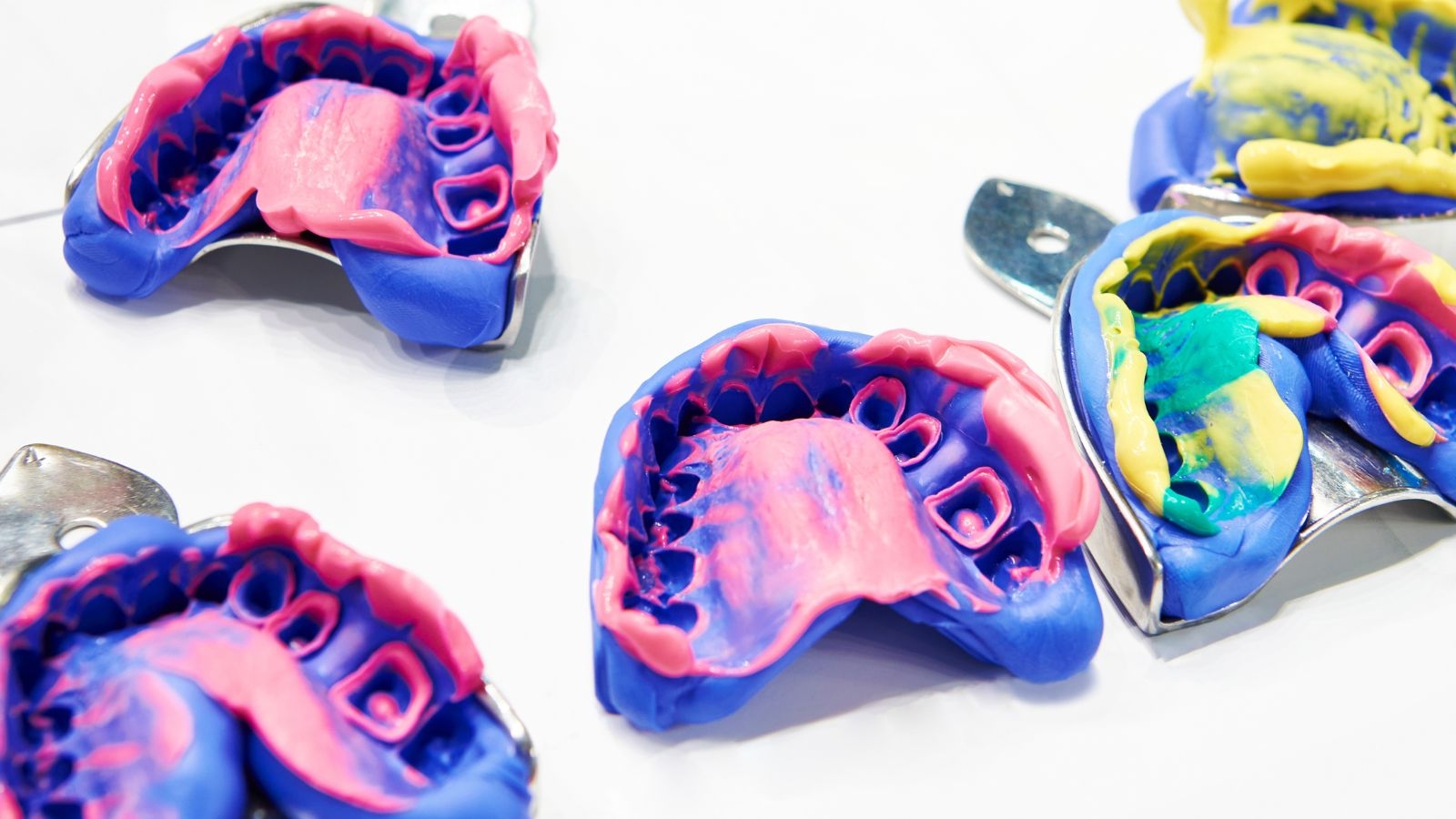 歯医者　型取り　苦しい