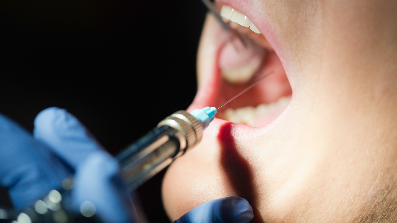 歯医者　麻酔　時間