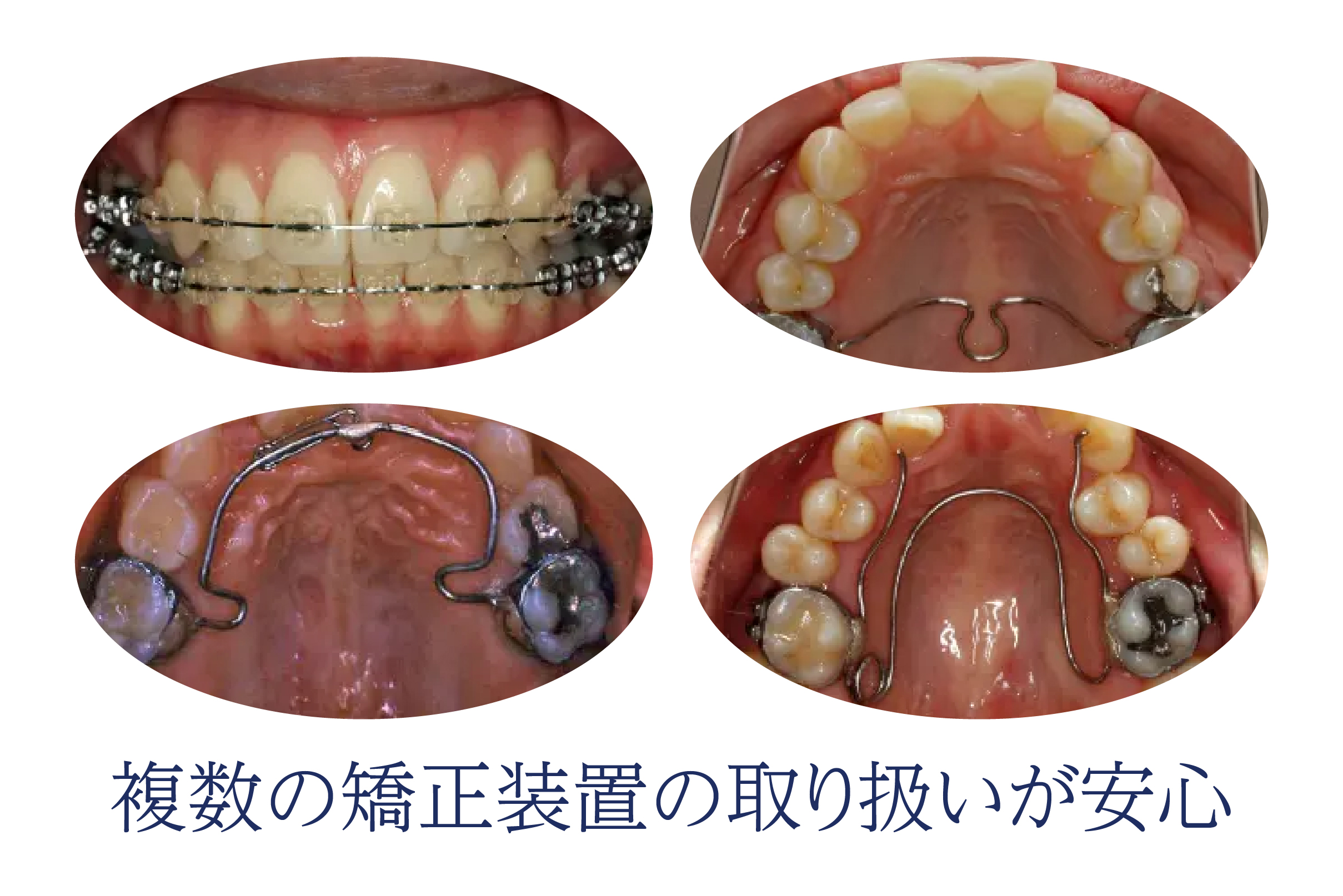 矯正歯科　選び方