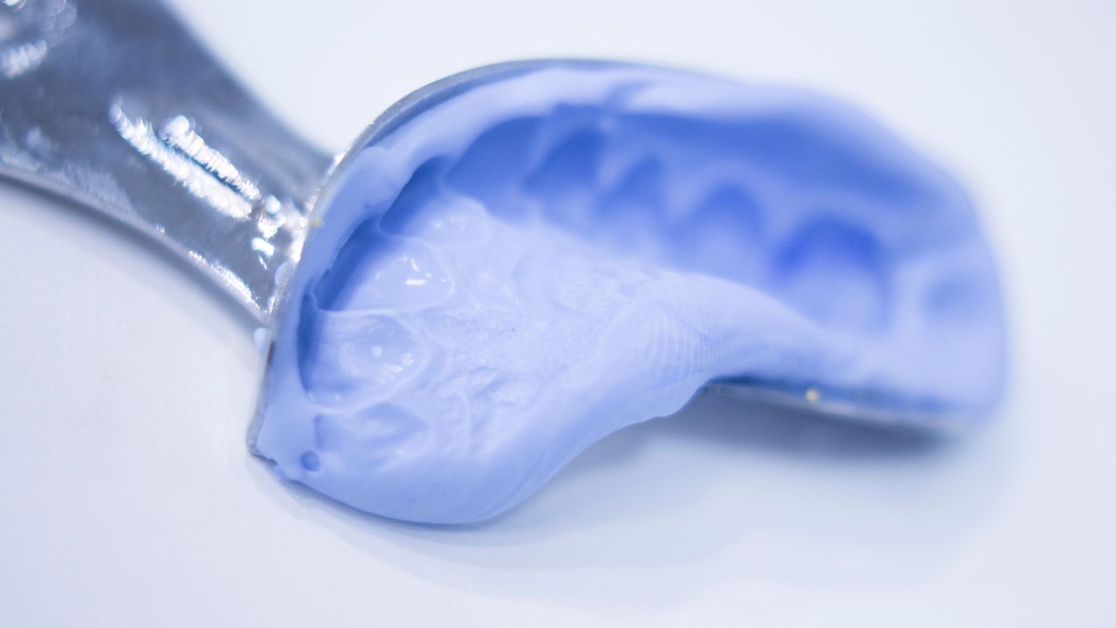 歯医者　型取り　苦しい