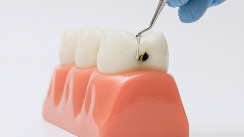 歯茎が腫れる原因と治し方