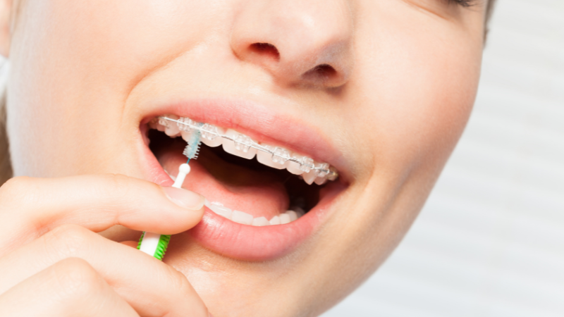 歯間ブラシ　サイズ