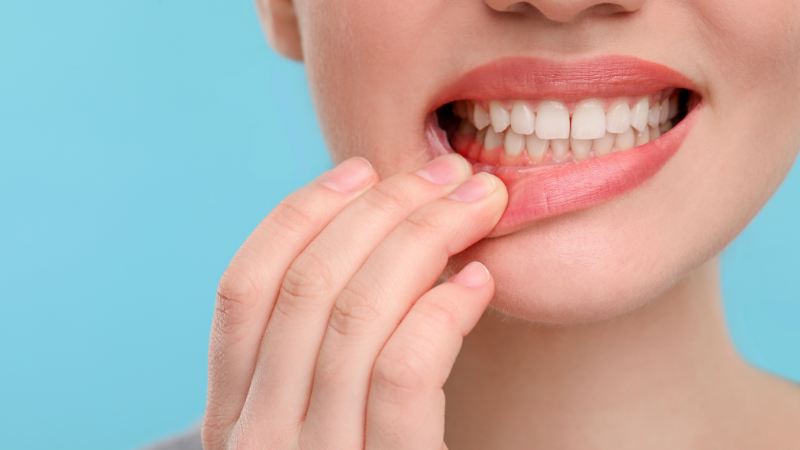 歯茎の腫れ 原因