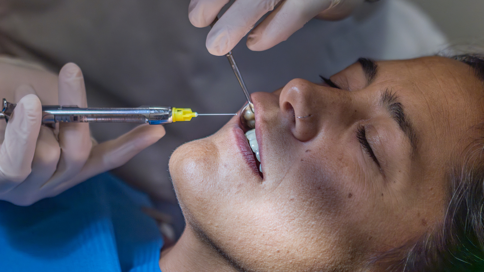 歯医者　麻酔　痛い