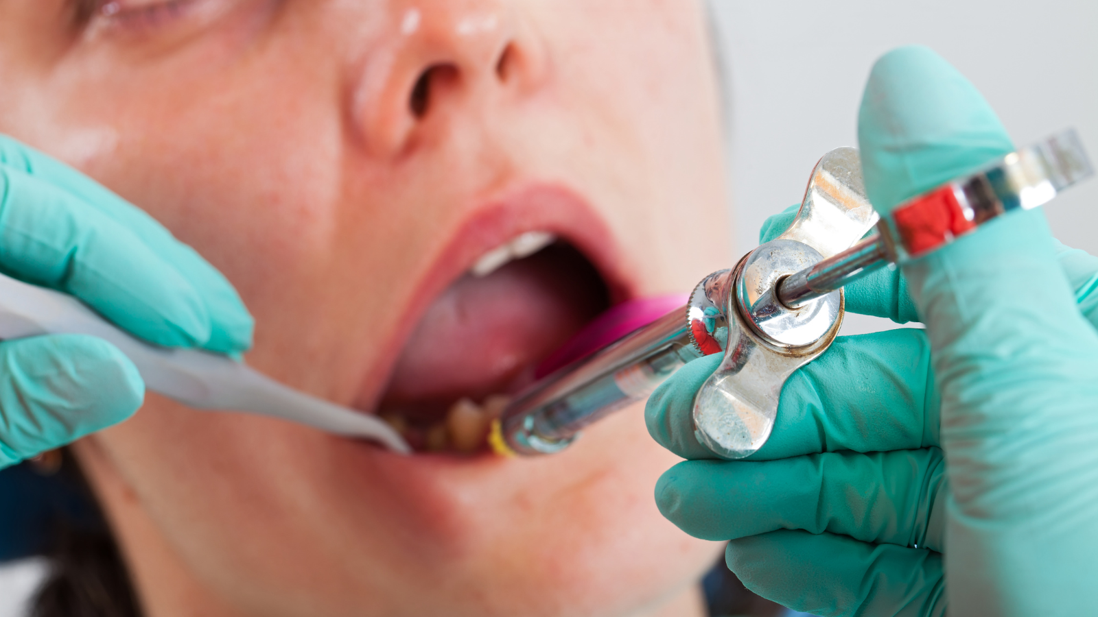 歯医者　麻酔　時間