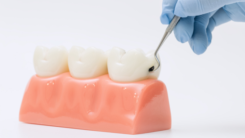 歯茎の腫れ 原因