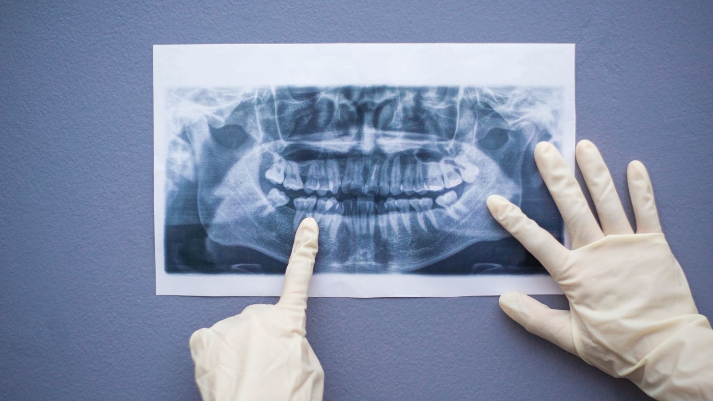 歯医者　定期検診　高い