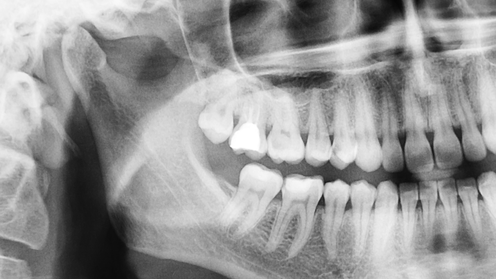 歯医者　初診料　レントゲン