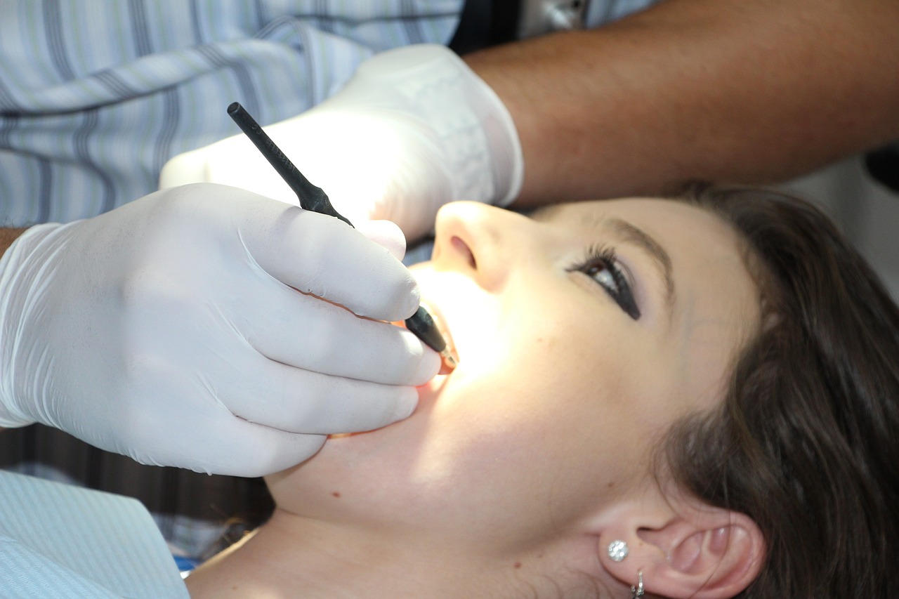 歯医者　歯科検診　頻度